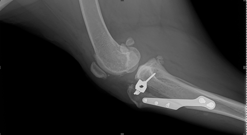 Postoperative lateral Tibial Tuberosity Advancement (TTA). TPLO and TTA offer the best outcome following a partial CrCL tear. 