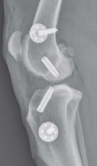 Figure 4A. Immediate postoperative lateral view.