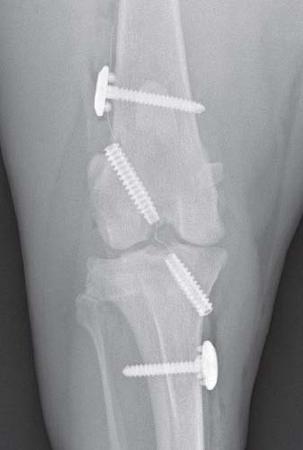 Figure 4B. Craniocaudal radiographs following placement of the synthetic ligament.