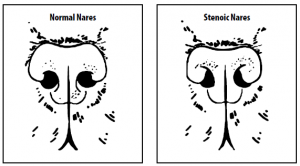 brachycephalic-syndrome-2