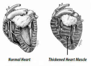 Feline Hypertrophic Cardiomyopathy (HCM)