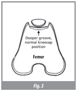 Patellar Luxation in dogs and cats