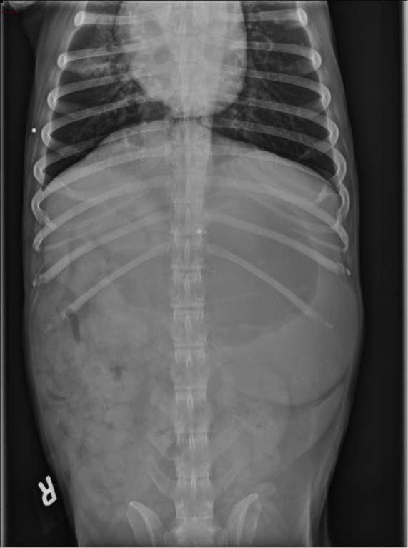 VD Abdominal Radiographs in Dog with Vomiting and Cough 