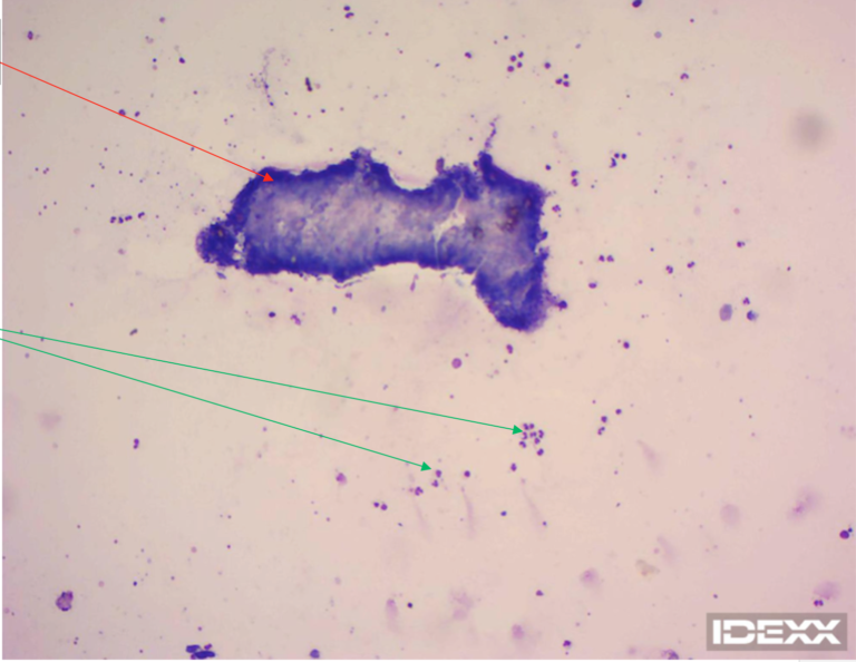 Figure 7. Larval cestode (red arrows) and neutrophils (green arrows), 100X. 