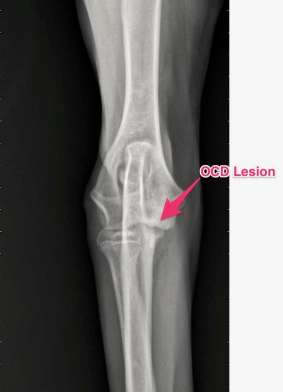 Figure 2. AP radiograph of the elbow on a dog with foreleg lameness. Note the OCD lesion (red arrow). 