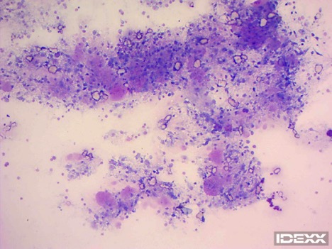 Figure 3. Abdominal fluid cytology viewed at 500X.