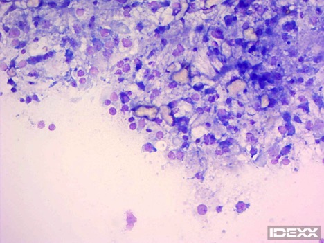 Figure 5. Abdominal fluid cytology viewed at 1000X.