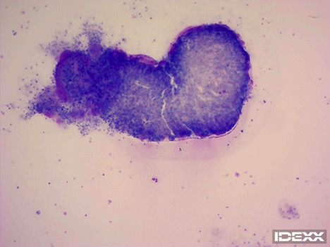 Figure 6. Mesocestode thyridia 200x.