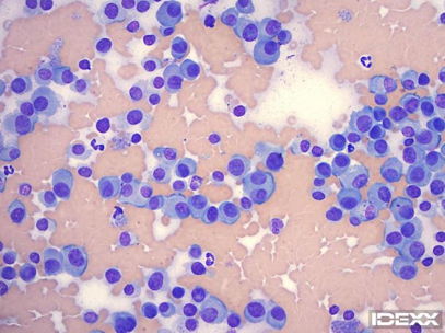 Figure 1. Interdigital mass. 500x magnification, Wright-Giemsa stain.