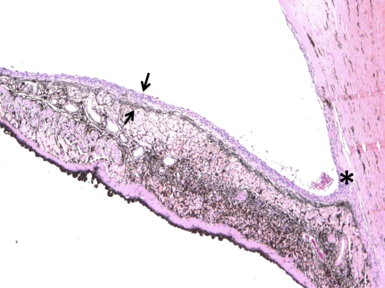 Diagnosis and Treatment of Canine Glaucoma