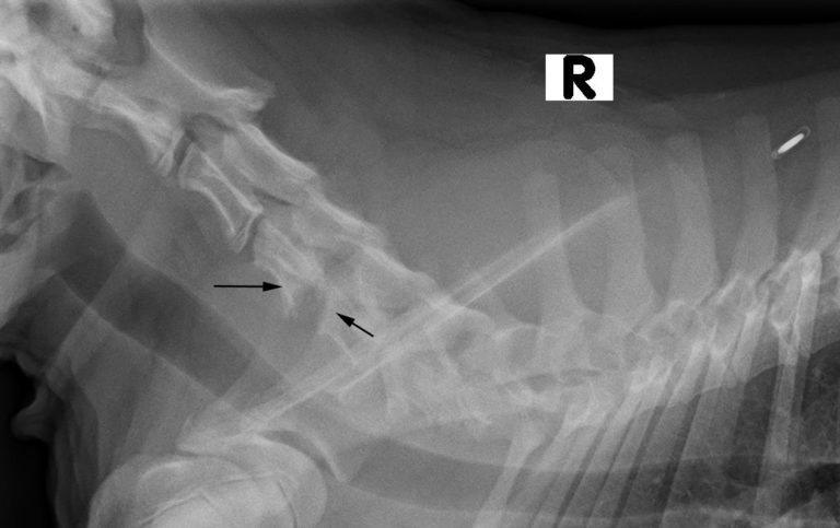 Figure 3. Lateral radiograph of the spine. Note lucent appearance of the caudal endplate of C4 and the cranial endplate of C5 consistent with the presence of lysis.