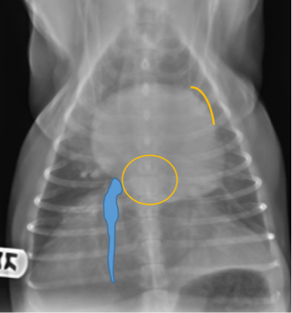 Figure 9. Ventrodorsal thoracic radiograph from a dog. Notice the enlarged left atrium summates as an ovoid soft tissue opacity over the mid-caudal aspect of the cardiac silhouette. Sometimes left auricular (left atrial appendage) enlargement or displacement occurs concurrently in severe cases of left atrial enlargement. In these cases, the left auricle is seen as a soft tissue convexity on the cardiac silhouette at the 2-3 o’clock position on the ventrodorsal or dorsoventral projection.