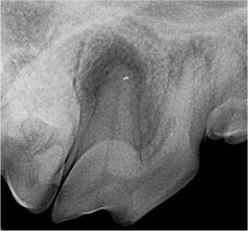 Dental Xray from a dog right maxillary fourth premolar. 