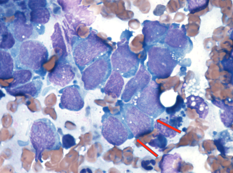 Fine needle aspirate form a puppy with an abdominal mass. Representative cells with a round to polygonal shape with occasional distinct cytoplasmic junctions (arrows). 