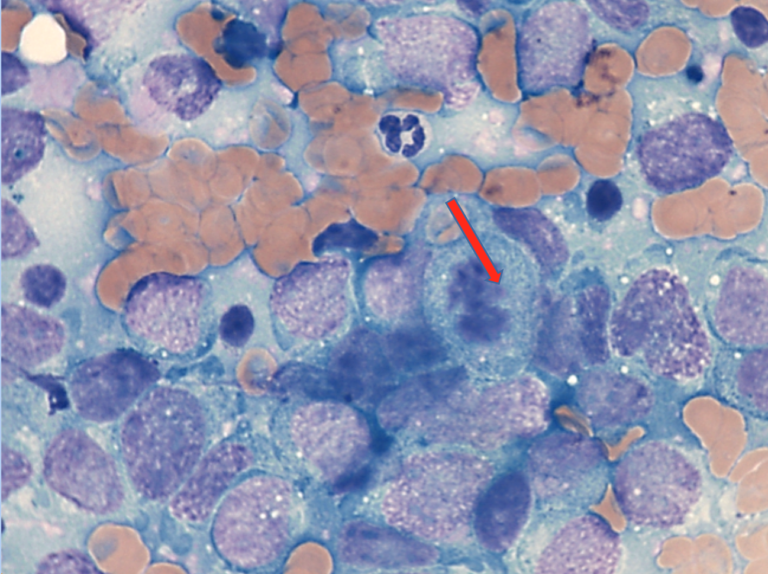 . Fine needle asparite from a puppy with an abdominal mass. Representative cells with a mitotic figure (arrow). 